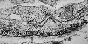 M,22y. | pinocytotic vesicles in the endothelial cell M,22y. | pinocytotic vesicles in the endothelial cell